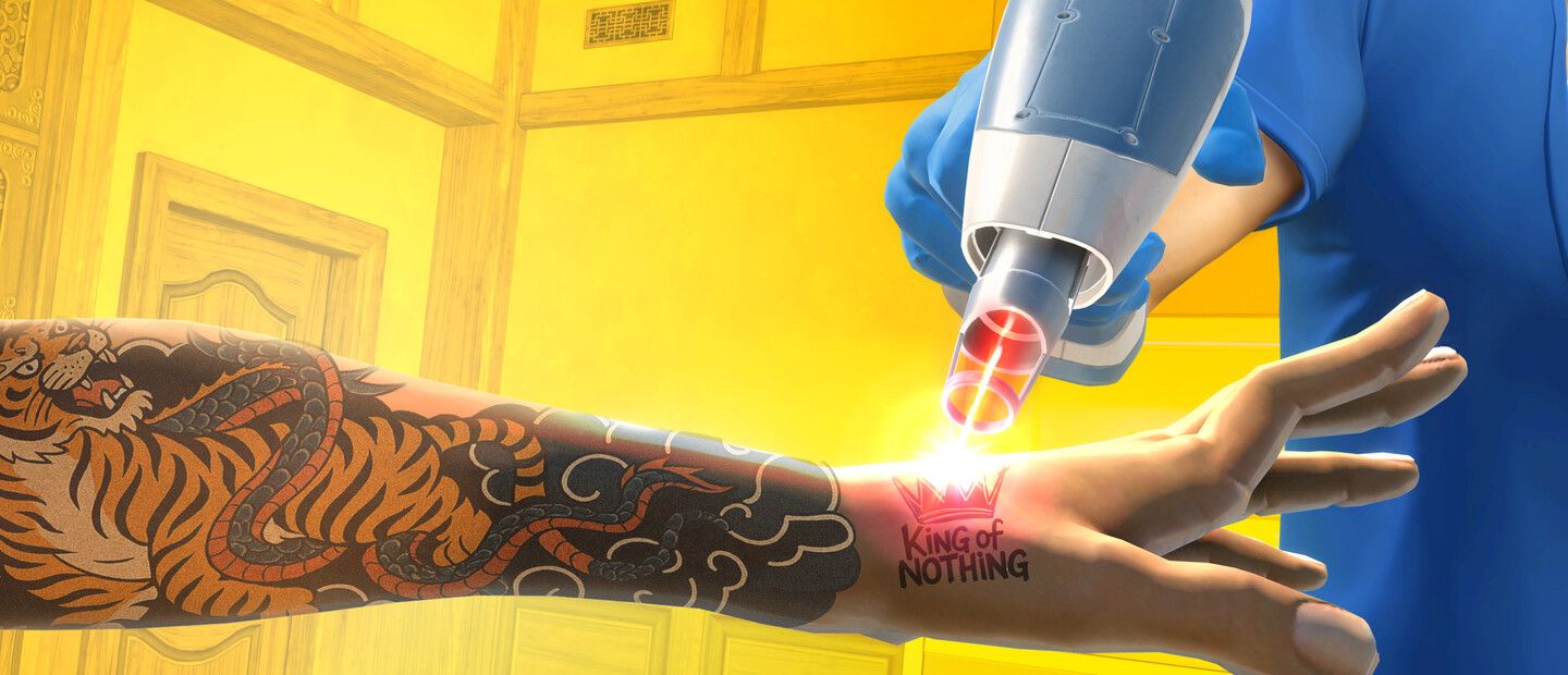 Tattoo Removal Simulator